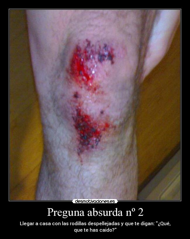 Preguna absurda nº 2 - 