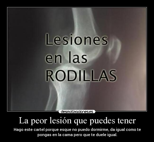 La peor lesión que puedes tener - 