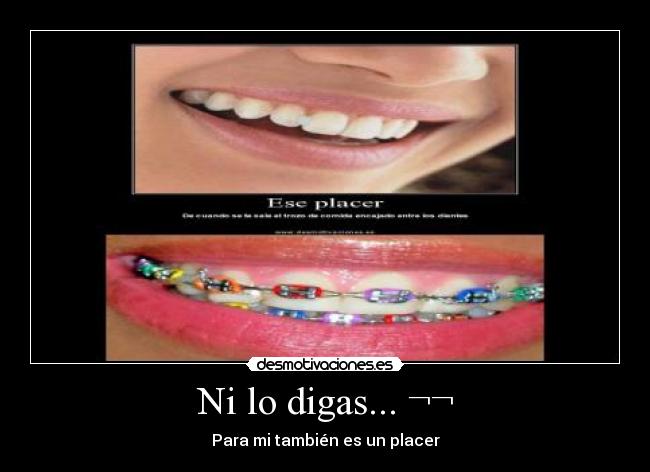 Ni lo digas... ¬¬ - Para mi también es un placer