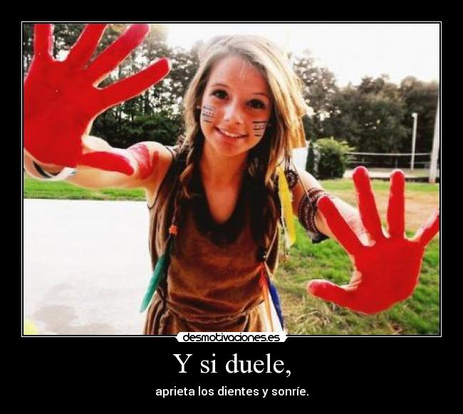 Y si duele, - 