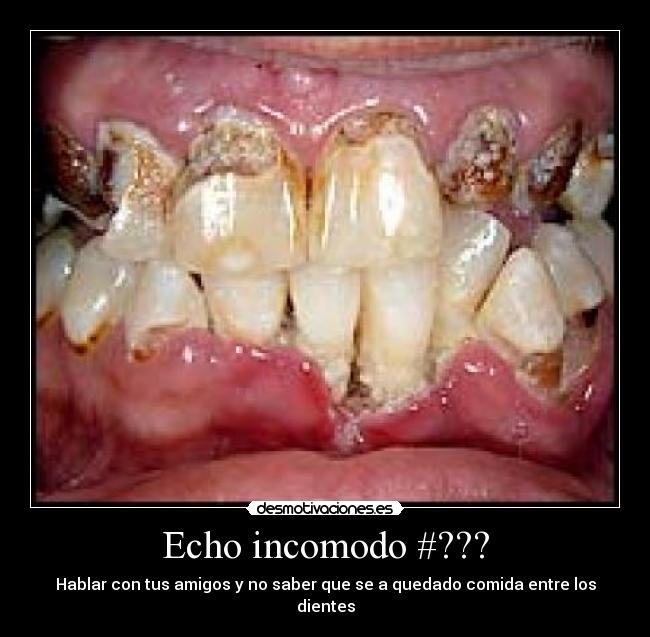 Echo incomodo #??? - Hablar con tus amigos y no saber que se a quedado comida entre los dientes