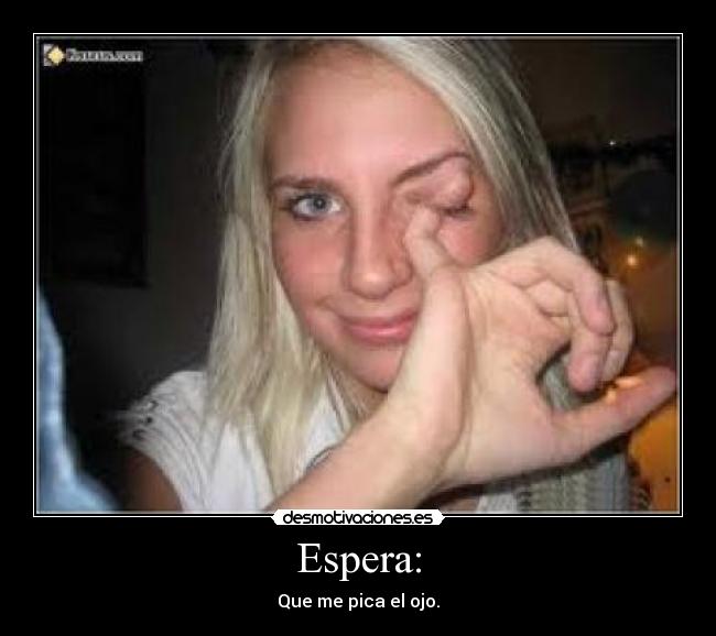 Espera: - Que me pica el ojo.
