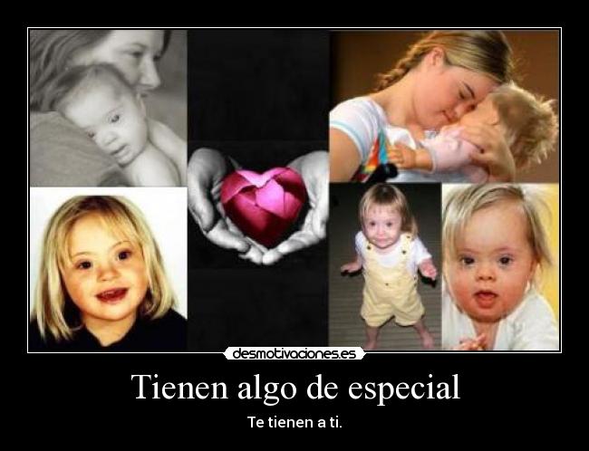 Tienen algo de especial -