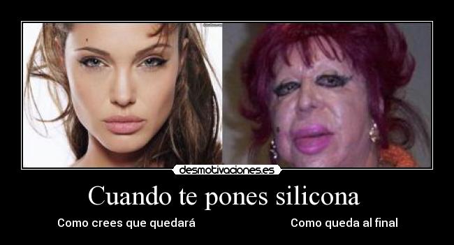 Cuando te pones silicona  - Como crees que quedará                                  Como queda al final