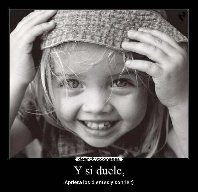 Y si duele, - 