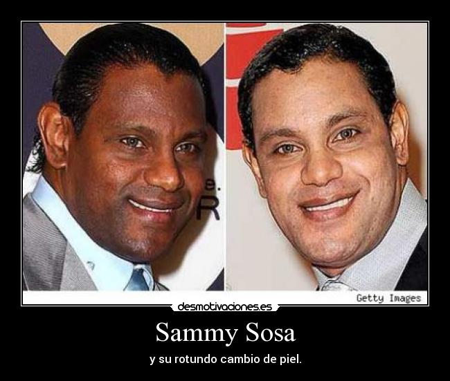 Sammy Sosa -