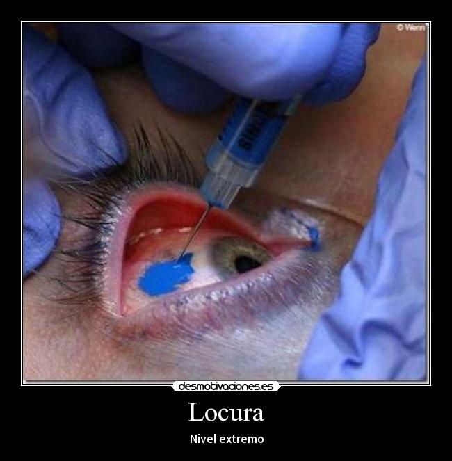 Locura - 