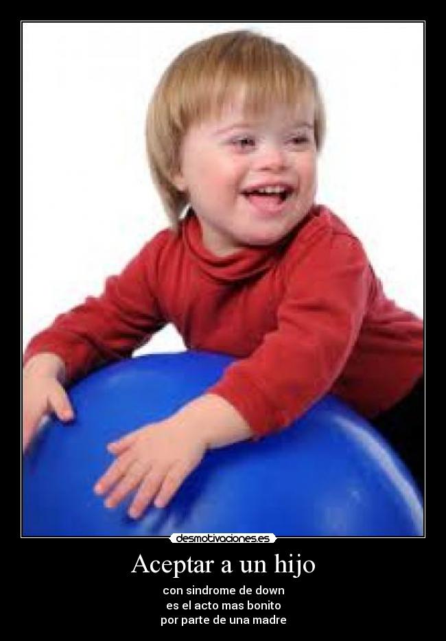 Aceptar a un hijo - con sindrome de down
es el acto mas bonito
por parte de una madre