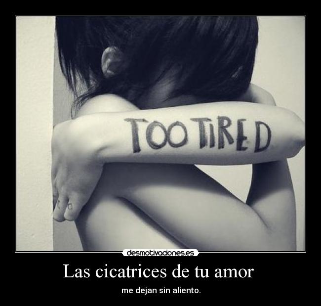 Las cicatrices de tu amor - me dejan sin aliento.