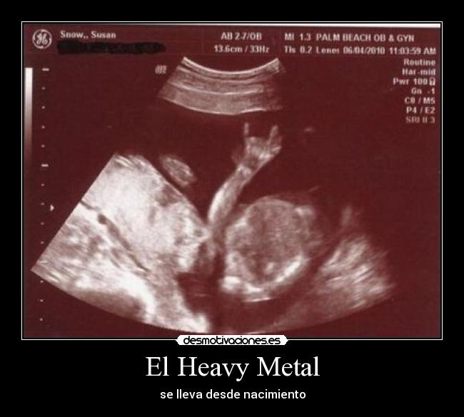 El Heavy Metal - se lleva desde nacimiento