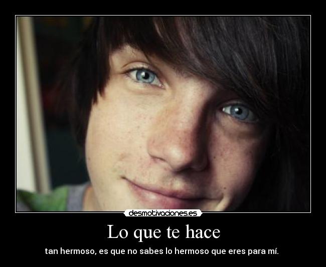 Lo que te hace - tan hermoso, es que no sabes lo hermoso que eres para mí.
