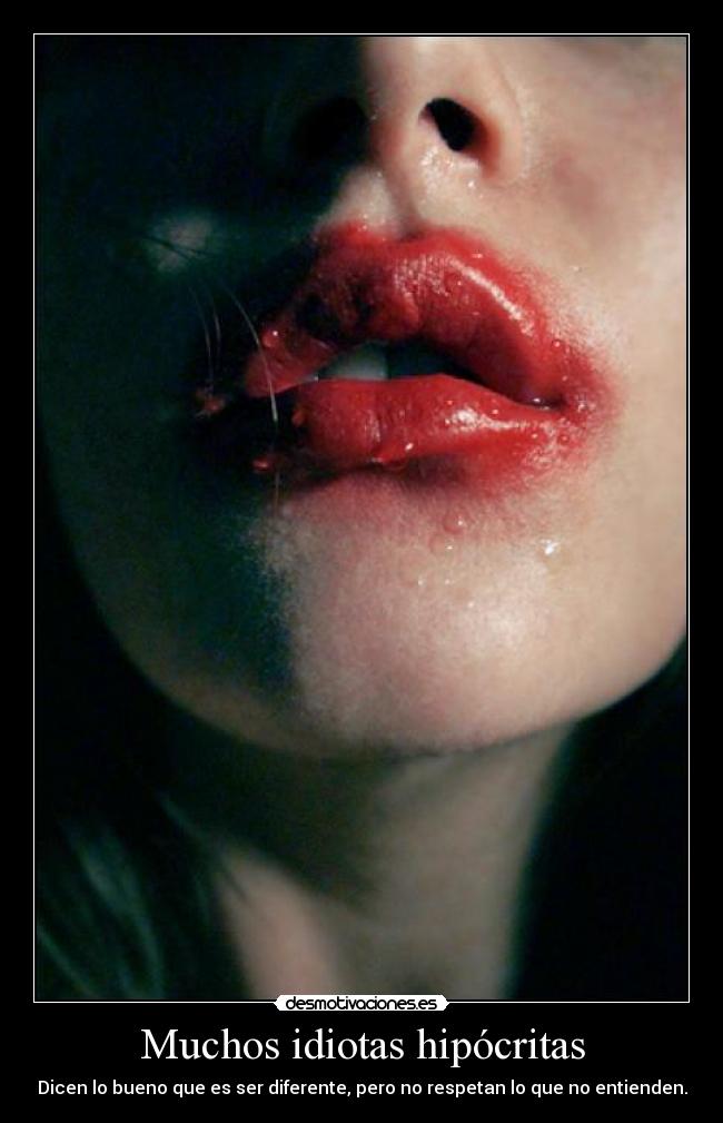 Muchos idiotas hipócritas - Dicen lo bueno que es ser diferente, pero no respetan lo que no entienden.