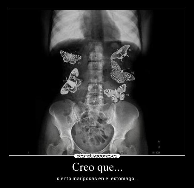 Creo que... - 