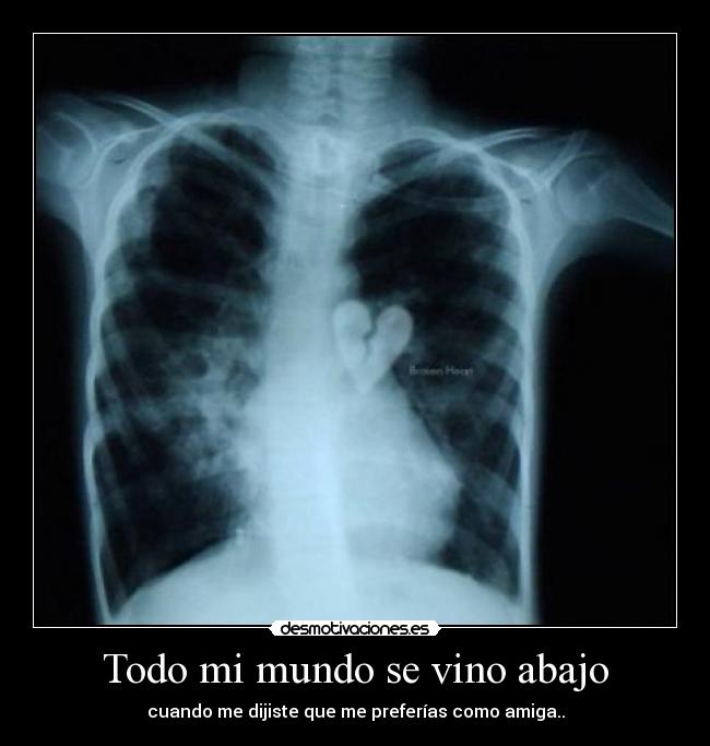 Todo mi mundo se vino abajo - cuando me dijiste que me preferías como amiga..