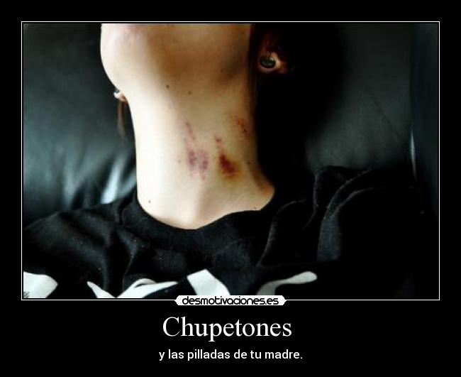 Chupetones -