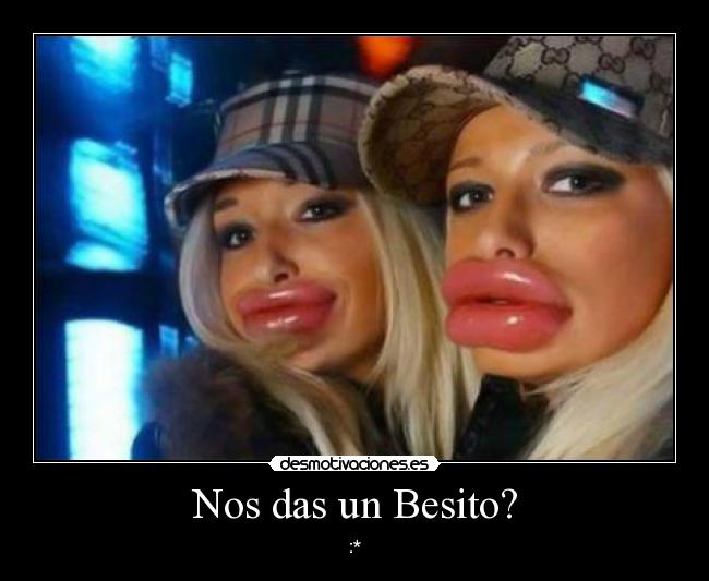 Nos das un Besito? - 