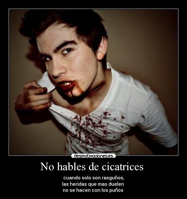 carteles hables cicatrices cuando solo son rasgunos las heridas que mas duelen hacen con los desmotivaciones