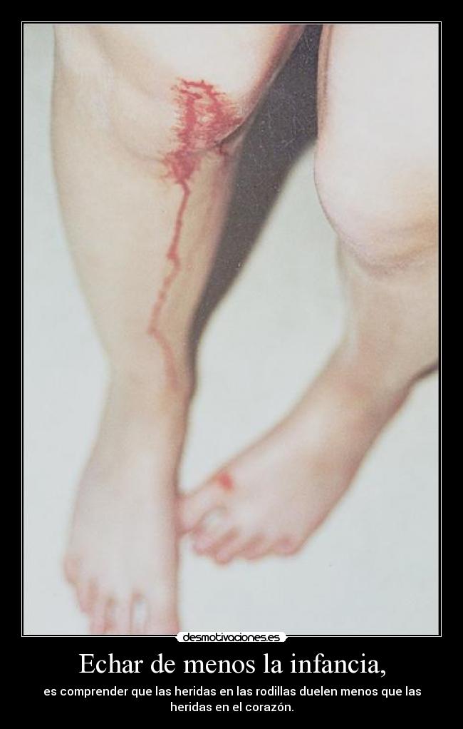Echar de menos la infancia, - 