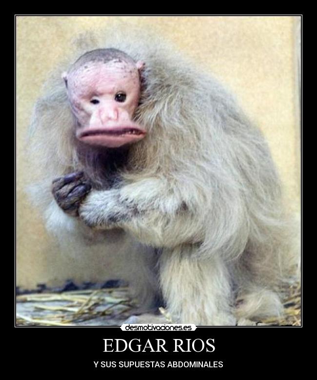 EDGAR RIOS - Y SUS SUPUESTAS ABDOMINALES