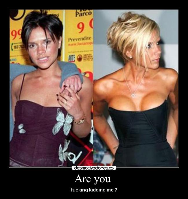 Are you - fucking kidding me ?