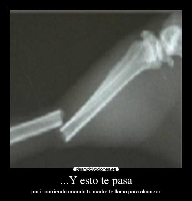 ...Y esto te pasa - por ir corriendo cuando tu madre te llama para almorzar.