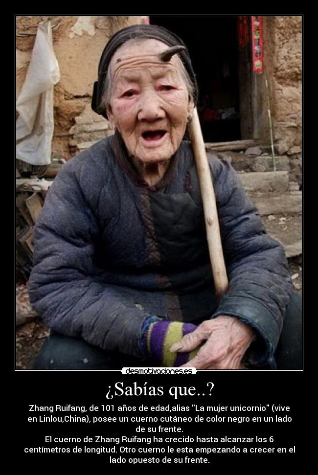 ¿Sabías que..? - Zhang Ruifang, de 101 años de edad,alias La mujer unicornio (vive
en Linlou,China), posee un cuerno cutáneo de color negro en un lado
de su frente.
El cuerno de Zhang Ruifang ha crecido hasta alcanzar los 6
centímetros de longitud. Otro cuerno le esta empezando a crecer en el
lado opuesto de su frente.