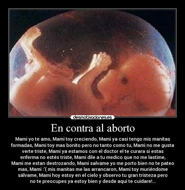 En contra al aborto - Mami yo te amo, Mami toy creciendo, Mami ya casi tengo mis manitas
formadas, Mami toy mas bonito pero no tanto como tu, Mami no me gusta
verte triste, Mami ya estamos con el doctor el te curara si estas
enferma no estés triste, Mami dile a tu medico que no me lastime,
Mami me estan destrozando, Mami salvame yo me porto bien no te pateo
mas, Mami :( mis manitas me las arrancaron, Mami toy muriéndome
sálvame, Mami hoy estoy en el cielo y observo tu gran tristeza pero
no te preocupes ya estoy bien y desde aqui te cuidare!...