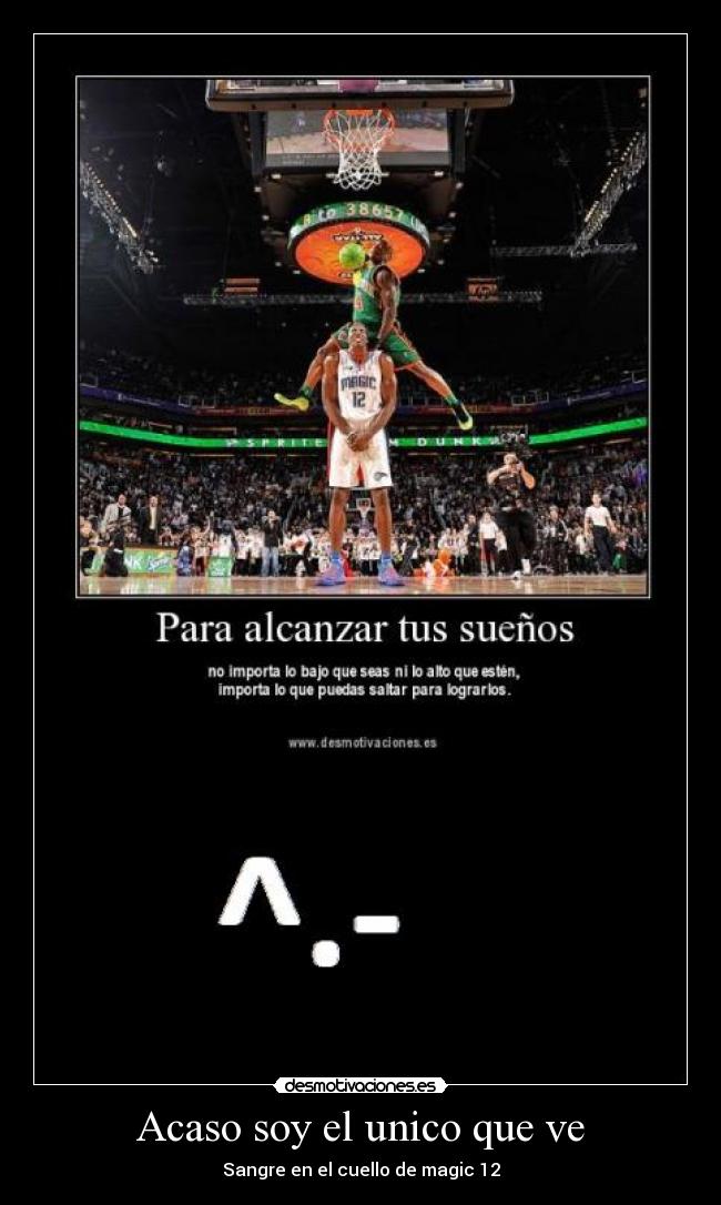 Acaso soy el unico que ve - 