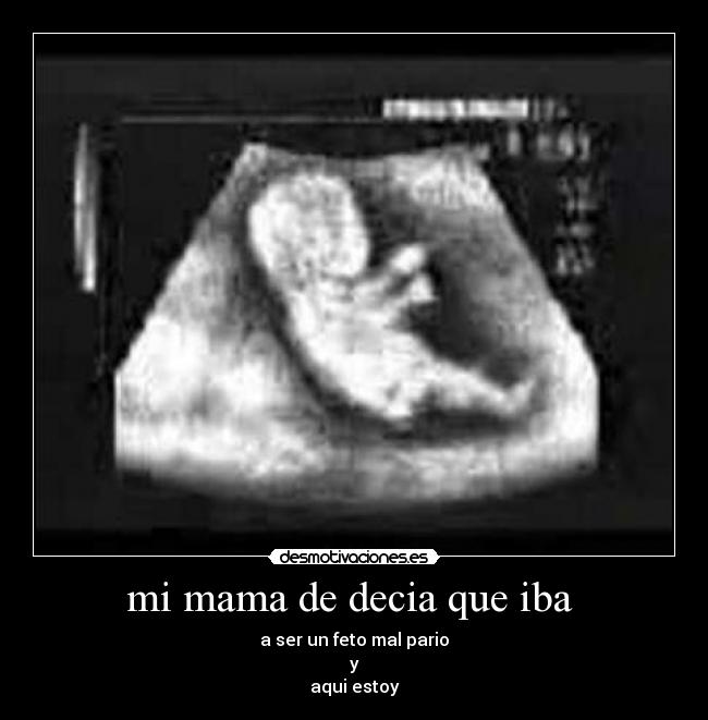 mi mama de decia que iba  - a ser un feto mal pario
y
aqui estoy