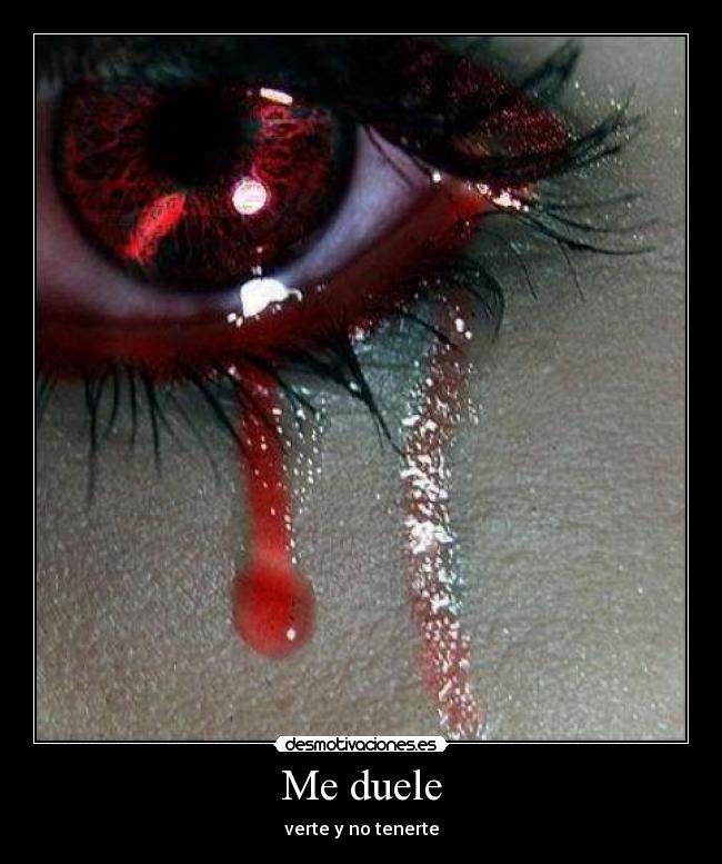 Me duele - 