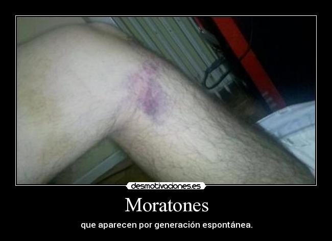 Moratones - 