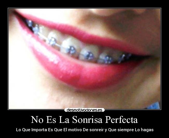 No Es La Sonrisa Perfecta - Lo Que Importa Es Que El motivo De sonreir y Que siempre Lo hagas