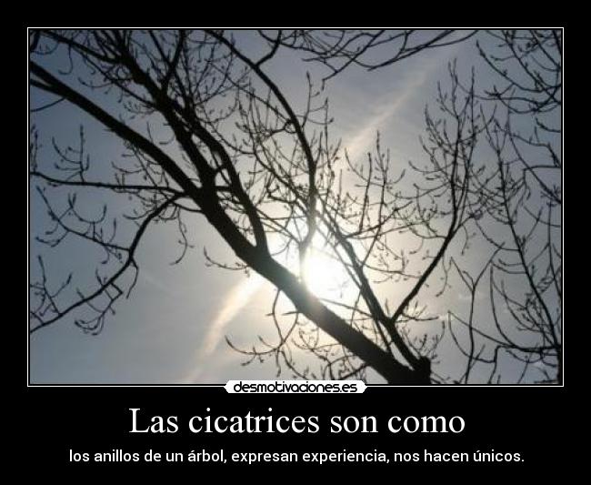 Las cicatrices son como - los anillos de un árbol, expresan experiencia, nos hacen únicos.