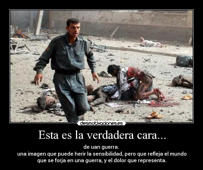 Esta es la verdadera cara... - de uan guerra.
una imagen que puede herir la sensibilidad, pero que refleja el mundo
que se forja en una guerra, y el dolor que representa.