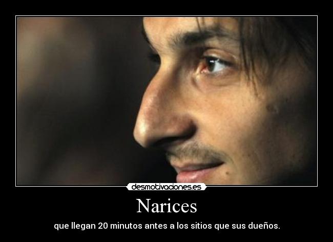 Narices - que llegan 20 minutos antes a los sitios que sus dueños.