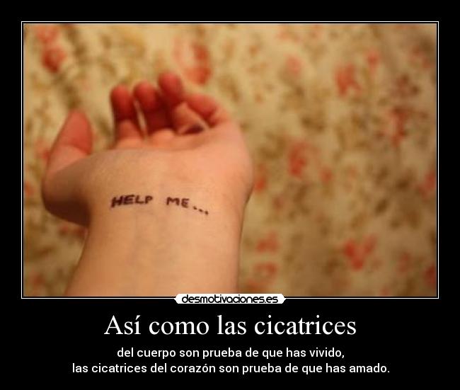Así como las cicatrices - 