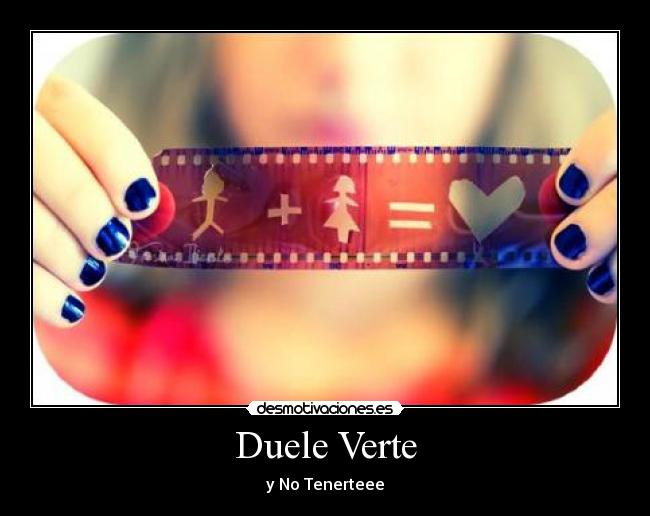 Duele Verte - y No Tenerteee