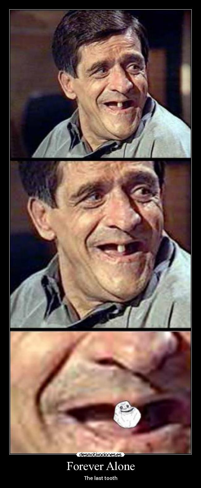 Forever Alone - The last tooth