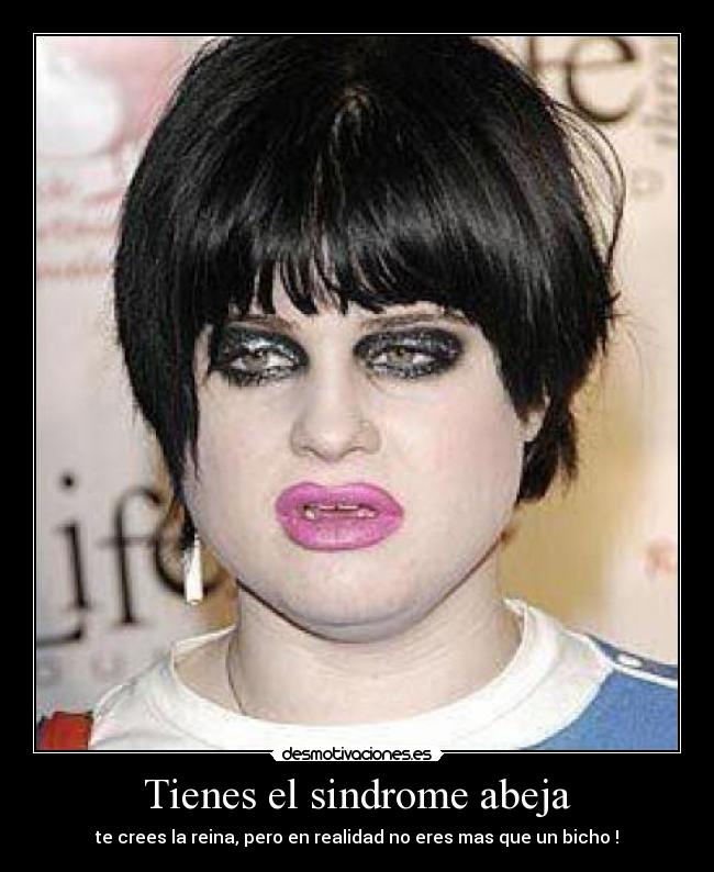 Tienes el sindrome abeja - te crees la reina, pero en realidad no eres mas que un bicho !