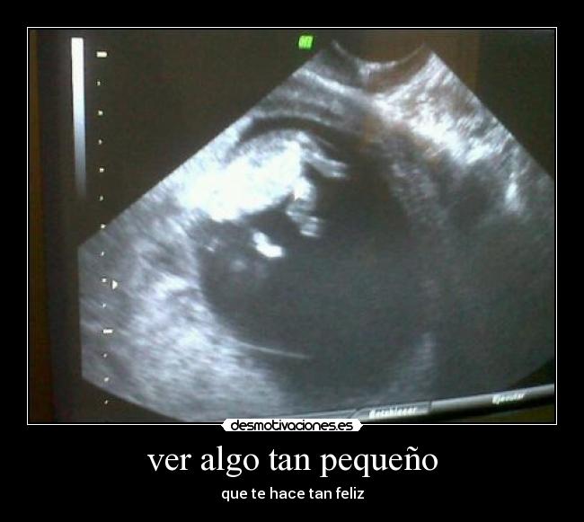 ver algo tan pequeño - 