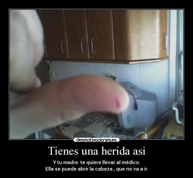 Tienes una herida asi - Y tu madre  te quiere llevar al médico.
Ella se puede abrir la cabeza , que no va a ir.