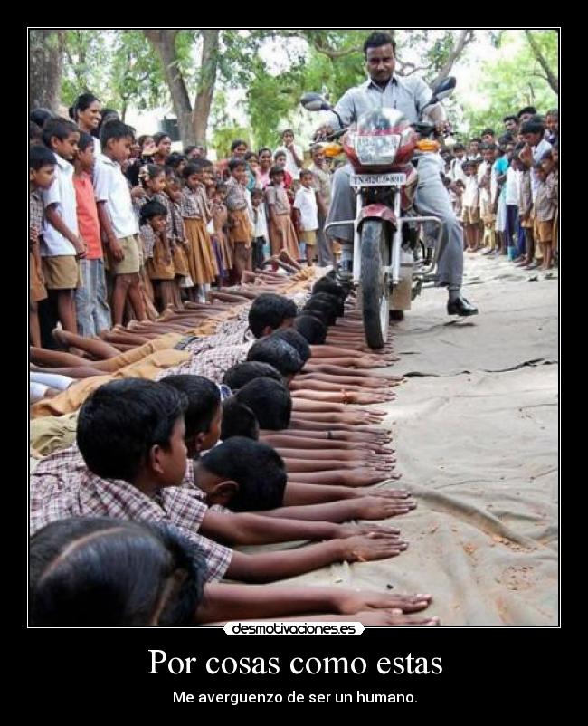 Por cosas como estas -