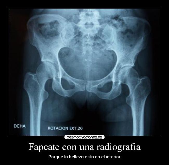Fapeate con una radiografia - Porque la belleza esta en el interior.