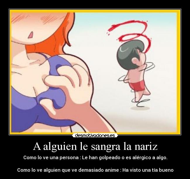 A alguien le sangra la nariz -