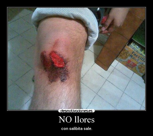 NO llores -