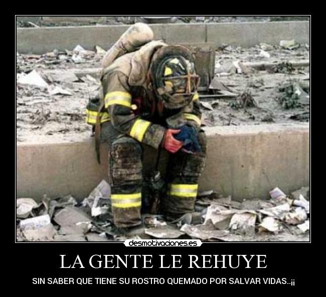 LA GENTE LE REHUYE - SIN SABER QUE TIENE SU ROSTRO QUEMADO POR SALVAR VIDAS..¡¡