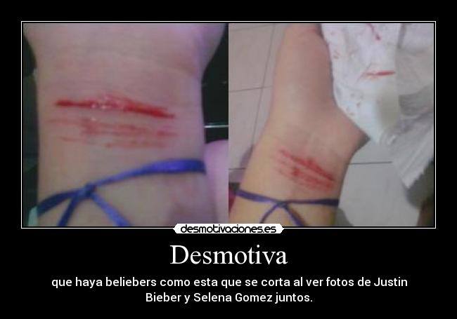 Desmotiva - que haya beliebers como esta que se corta al ver fotos de Justin
Bieber y Selena Gomez juntos.