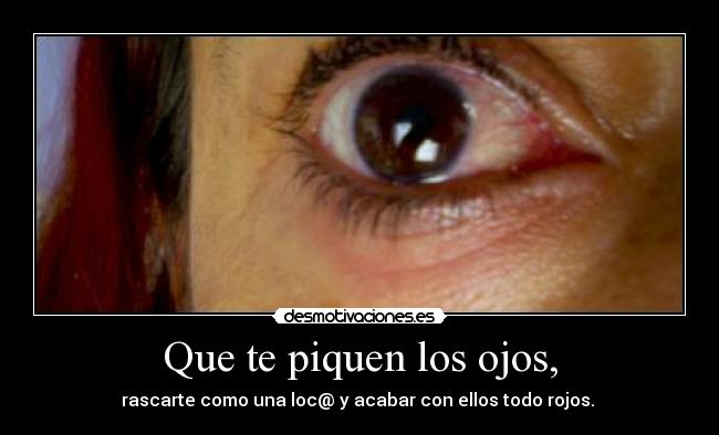 Que te piquen los ojos, - rascarte como una loc@ y acabar con ellos todo rojos. 