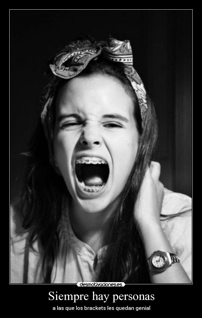Siempre hay personas - a las que los brackets les quedan genial