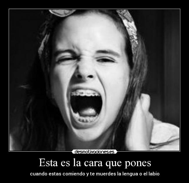 Esta es la cara que pones - cuando estas comiendo y te muerdes la lengua o el labio